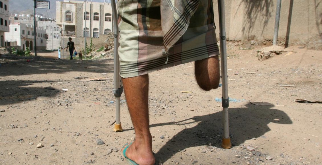 A man with an amputated leg walks on a street in Taiz in 2016. The city has been the scene of some of the fiercest fighting of Yemen's war (Reuters)
